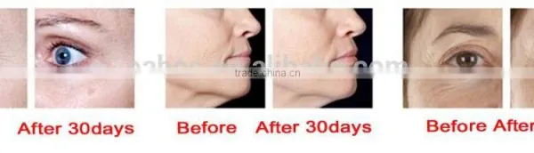 Red Light Anti Ageing Heat Skin Rejuvenation Beauty Device photo-4