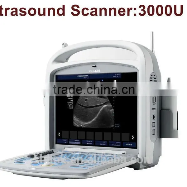 Super LINK Supply Digital Portable Ultrasound Scanner photo-6