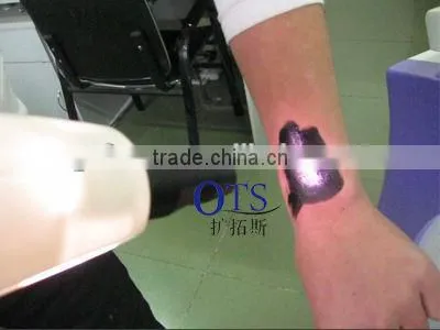 Freckles Removal Q Switched Nd Yag Laser Tattoo Black Head Removal Whitening Portable Machine Hori Naevus Removal photo-4