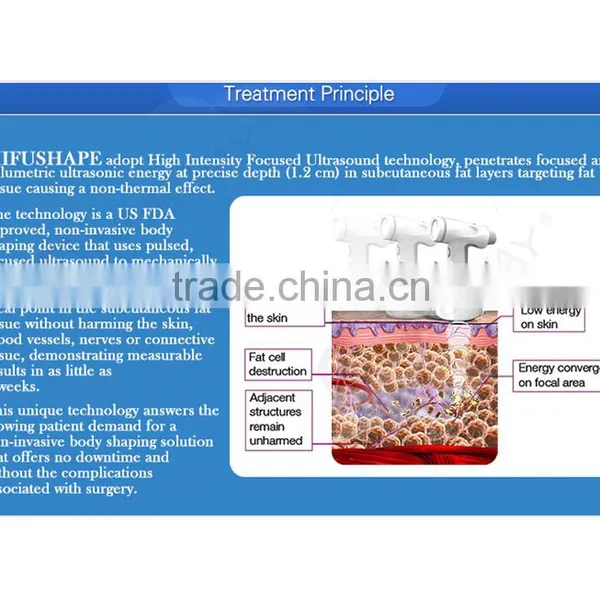 CE Approved Body Slimming Non-surgical Hifu Slimming Machine for Weight Loss photo-5
