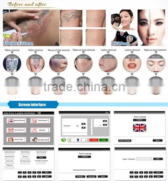 2016 New Multifunctional 2 in 1 Hair Removal Ipl Laser Pigmentation photo-5