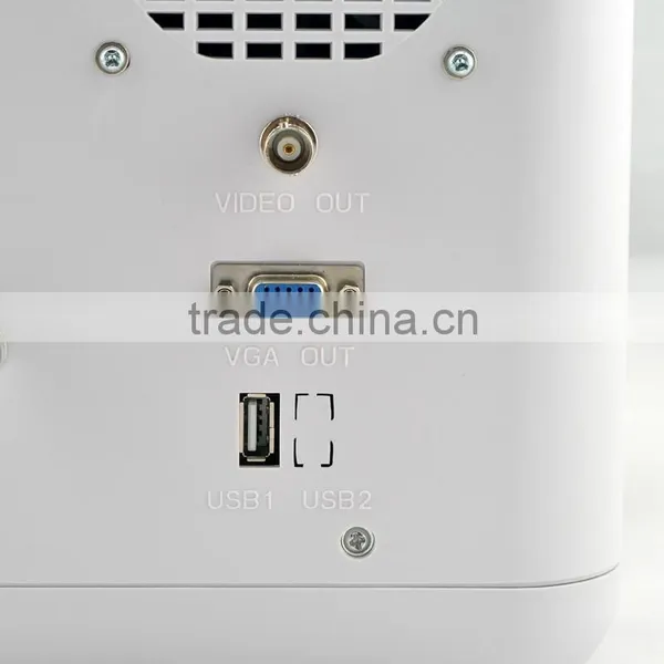 2016 Cheapest Portable Ultrasounic Diagnose Scanner Machine System With Convex/Linear/Cardic/Rectal Transducer Connector photo-6