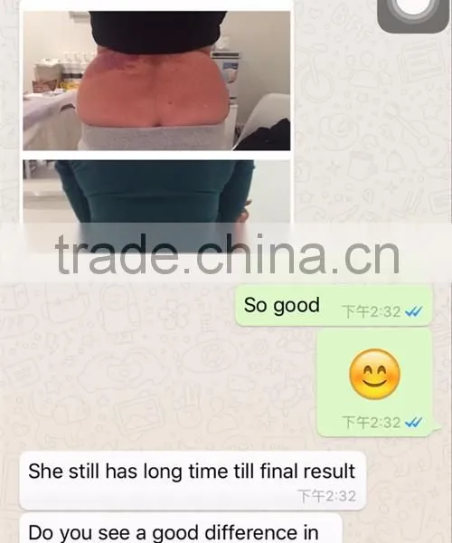 Skin Lifting Bottom Price Cryolipolysis Fat Fat Reduction Freeze Slimming Machine Cool Tech Body Shaping photo-6