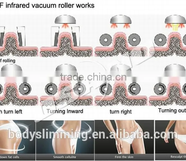 2015 Vacuum Roller Massage Equipment Cool Shape Machine photo-6