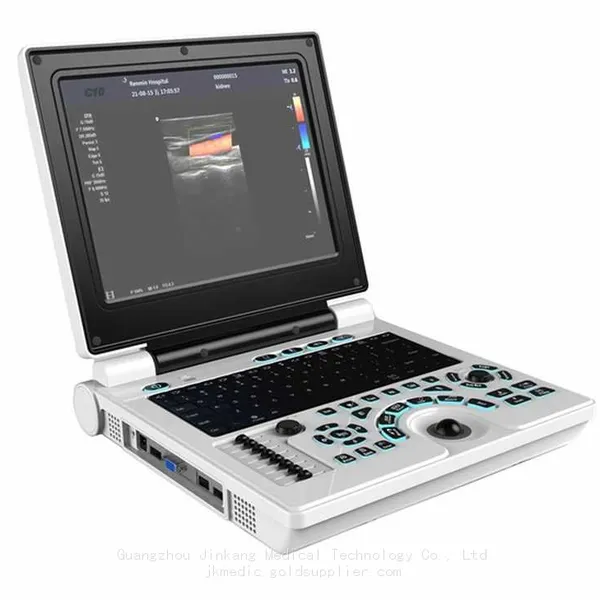 Color Ultrasound Machine, Color Doppler