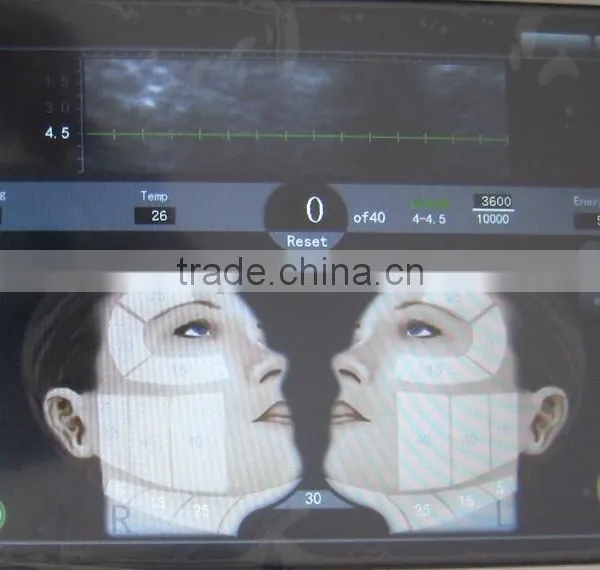 2015 Hot Sell HIFU Machine/HIFU High Hips Shaping Intensity Focused Ultrasound/HIFU Face Lift Chest Shaping photo-5