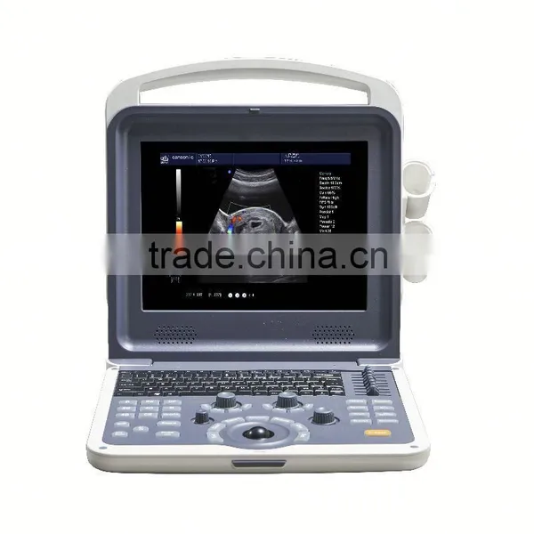 2016 Beautiful 3d/4d Ultrasound Color Doppler Scanner With Fetus