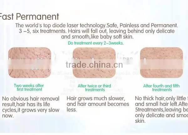 High Effect Vertical Hair Removal Machine Portable Diode Laser Hot Sale photo-5