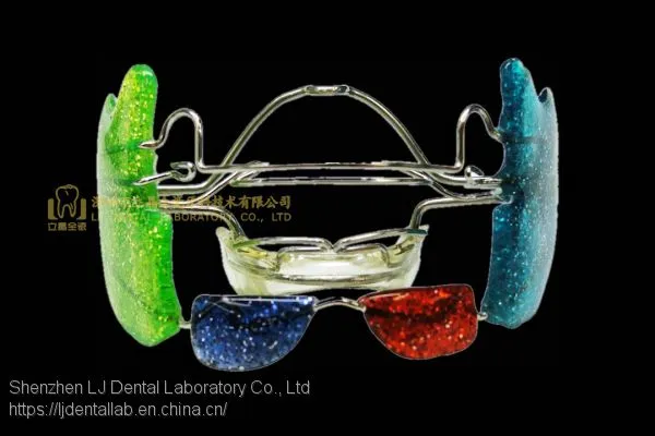 Dental Orthodontic Appliance, Bionator Appliance, Frankel Appliances, Fan-type Expander, Laboratoire Dentaire, Dentallabor, Laboratorio Dental, Dental Laboratory, Shenzhen LJ Dental Lab China