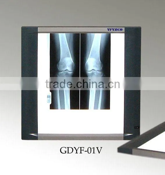 X-Ray Film Viewer