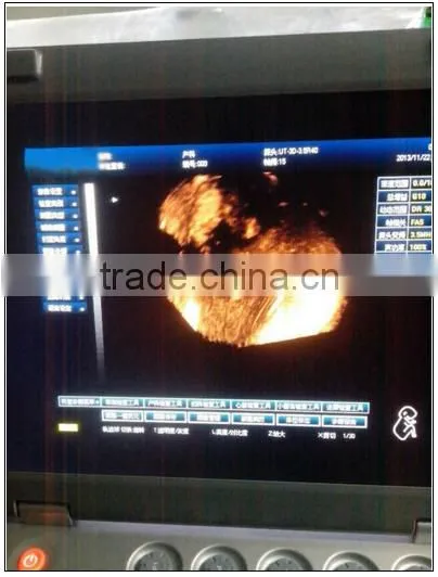 (MSLCU18)3D 4D Handheld Color Doppler Medical Ultrasound Scan Machine photo-4