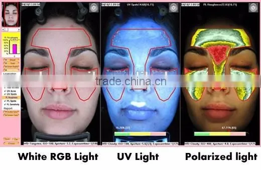 2014 Newest Portable Skin Hair AnalyzerSuitable For Windows 8 and Windows 8.1 photo-4