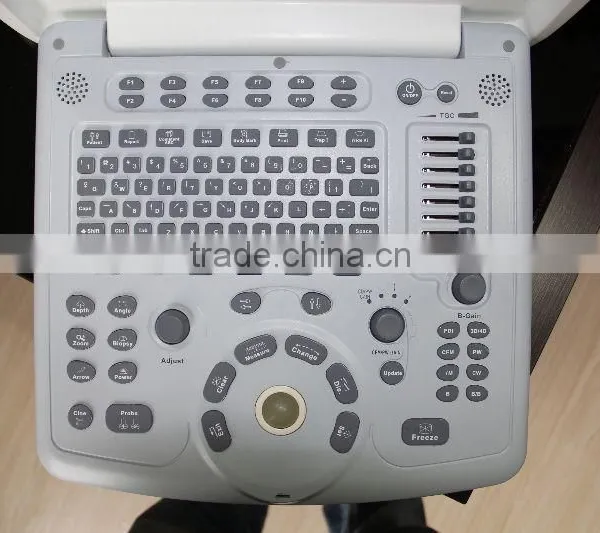 New Type Laptop Color Doppler Ultrasound for Human With Laptop photo-4
