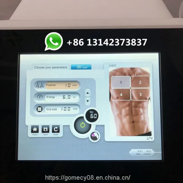 Portable Alma Laser Soprano Ice 755nm 808nm 1064nm Diode Laser Hair Reduction Equipment photo-3