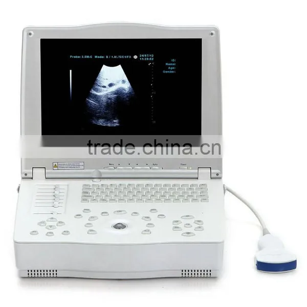 High Frequency Linear Probe Micro-convex Probe Convex Probe Laptop Ultrasound Scanner photo-2