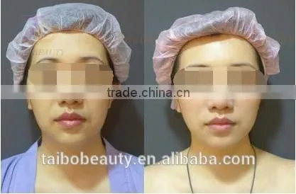 Spa Wanted Best Selling of Skin Lightening and Whitening Machine With Diamond Dermabrasion photo-5