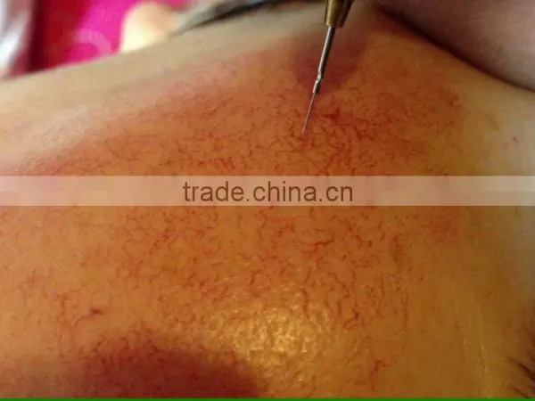 China Hair Salon Equipment Vascular Spider Vein Removal Machine photo-5