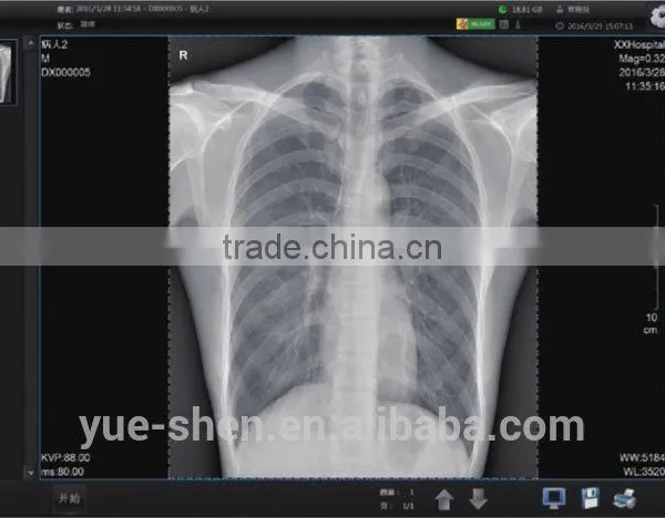 For All Kinds of X-ray Machine Flat Panel Digital X-ray System photo-5