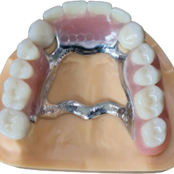 Zirconia All-Ceramic Crowns And Bridges Have No Irritation Or Allergic Reaction To The Gums photo-3