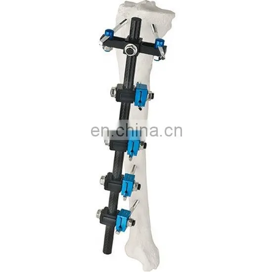 Orthopedic Surgical Instruments Femur&Tibial External Fixator for Femur&Tibia Surgery photo-4