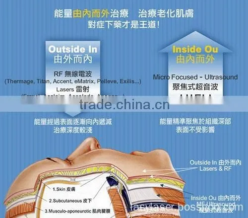 High Intensity Focused Ultrasound Hifu/ Hifu Anti-wrinkle With Amazing Effect photo-5