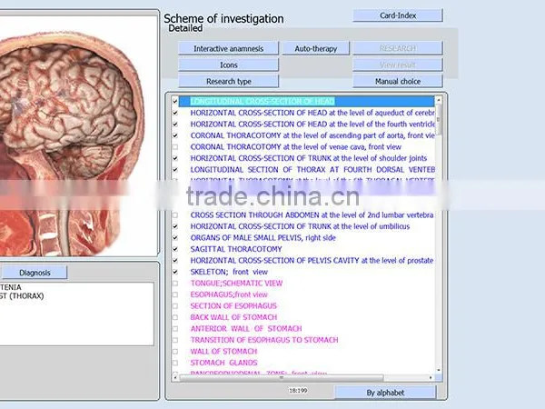 Quantum Therapy Machine Quantum Health Analyzer 9D Cell Health Analyzer photo-6