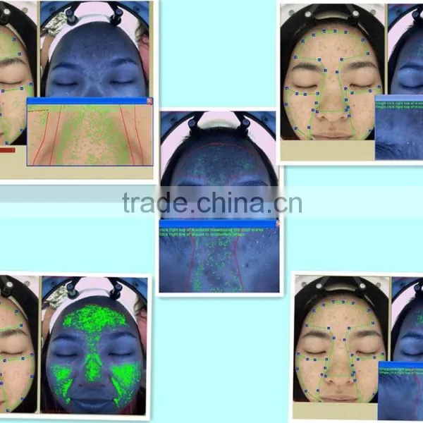 Mini Skin Analyzer Machine Gold Quantum Analyser photo-5