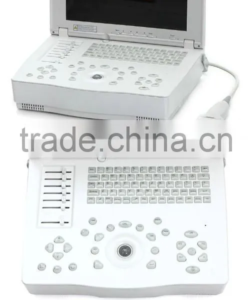 Hospital Clinical Equipment 15-inch Full Digital Laptop Ultrasound Scanner China Made Portable Ultrasound Machine photo-5