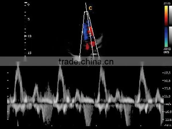 2016 New Portable Color Doppler(Optional 4D) for Cardiac Use photo-2