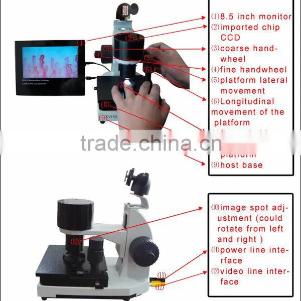 Nail Fold Capillary Microscope Portable Clincial Capillaroscope
