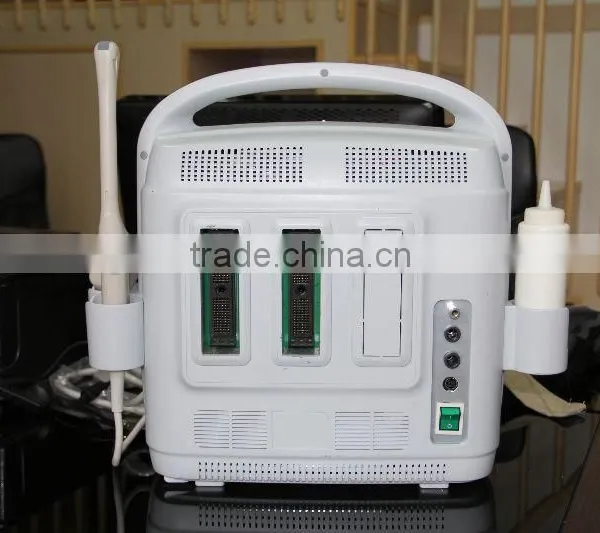 Hot Sale Color Doppler Ultrasound Machine for Sale photo-6