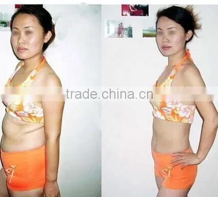 No-needle rf Skin Instrument for Facial Care Wrinkle Removal and Skin Tightening Whitening photo-2