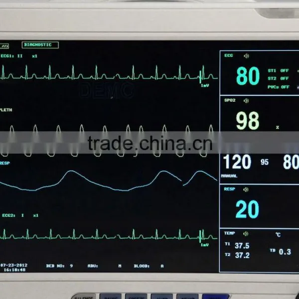 Carejoy 12 Inch Multi-parameter Patient Monitor Optional Printer RPM-9000A for Adult, Pediatrics and Neonate in Hospital ICU CCU photo-3