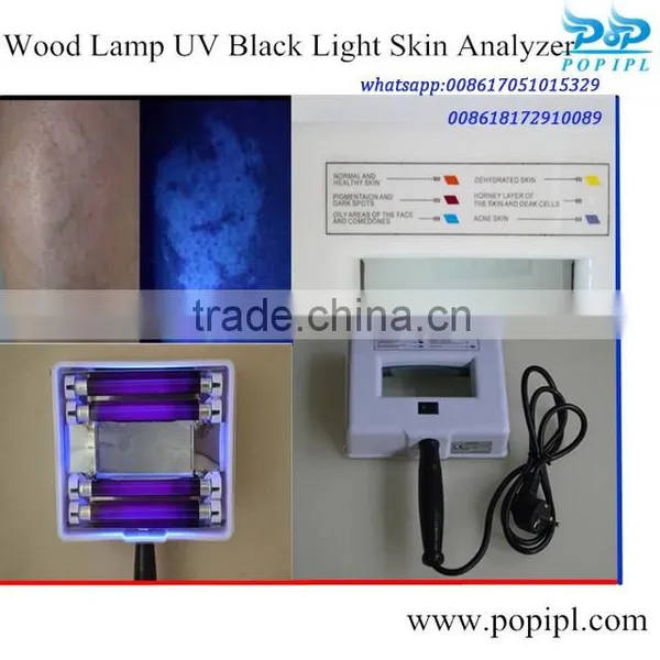 Hot Sale Wood Lamp /medical Woods Lamp/woods Lamp Beauty photo-2