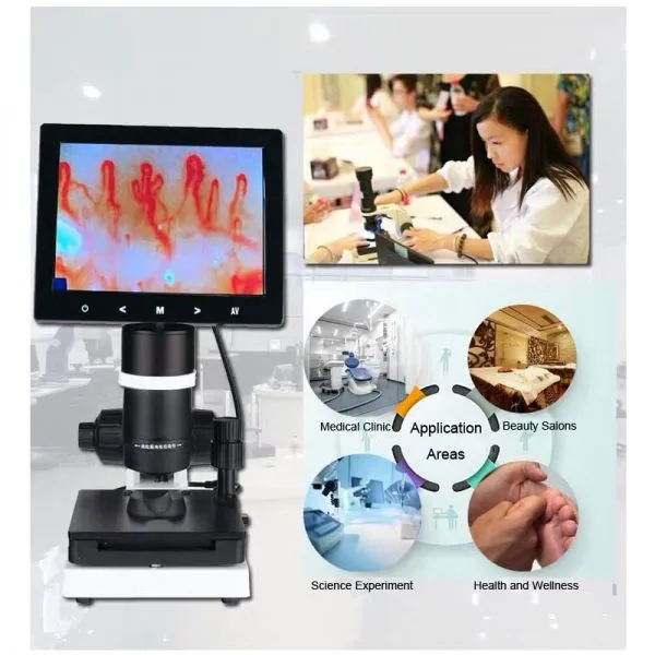 USB Microscope Blood Microcirculation Inspection Zoom Nailfold Capillary Microcirculation Digital Microscope With LCD Screen photo-4
