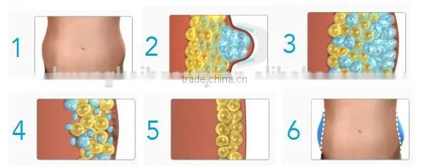 Wholesale China Factory Cool Tech Fat Freezing Slimming Machine photo-5