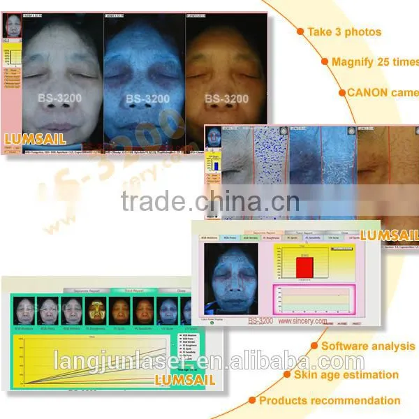 Cannon Camera USB2.0 Intelligent Boxy Skin and Hair Analyzer photo-5