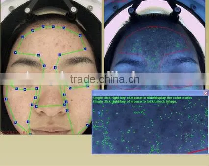 Professional High Definition 3D Function Digital Images Magic Mirror Skin Analyzer photo-6