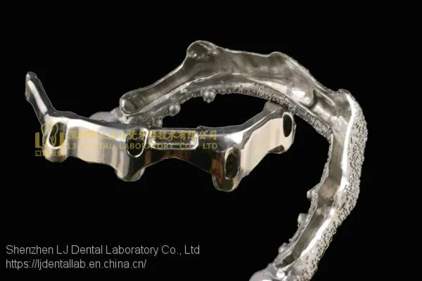 Dental Implant Bar, Implant Overdenture, Implant Prosthesis, Laboratoire Dentaire, Dentallabor, Laboratorio Dental, Dental Laboratory, Shenzhen LJ Dental Lab China photo-2