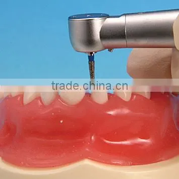 Pediatrics Typodont Teeth Model (20 Teeth) With Removable Screw Teeth photo-4