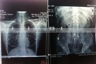 Dry Medical Thermal Dry Film KX410 X-ray Film Dry Film photo-3