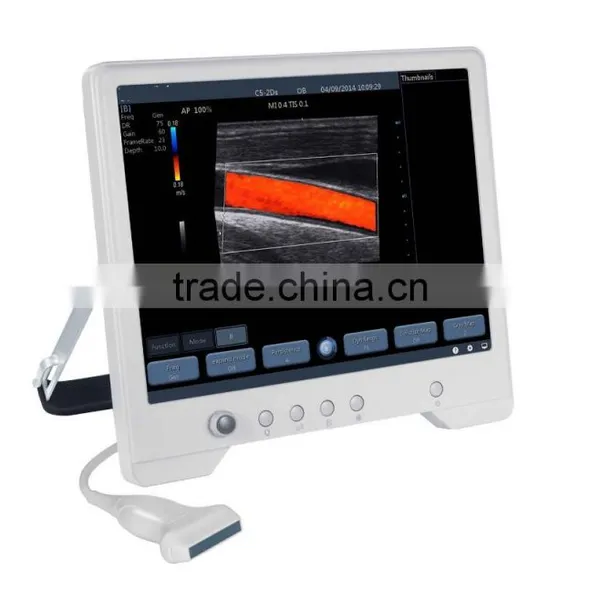 Full Touch Color Doppler Ultrasound System