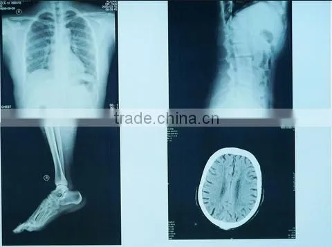 Japan Film Fuji X-ray Film Konica Dry Films photo-6
