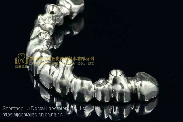 Full-arch Implant Bridge Prosthesis, Implant Denture Framework, Implant Prosthesis, Laboratoire Dentaire, Dentallabor, Laboratorio Dental, Dental Laboratory, Shenzhen LJ Dental Lab China photo-3