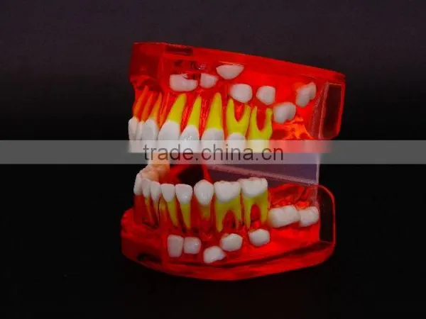 Bicolor Deciduous Teeth Development Model 1Teaching Demonstration Models photo-2