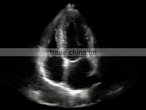 2016 New Portable Color Doppler(Optional 4D) for Cardiac Use photo-5