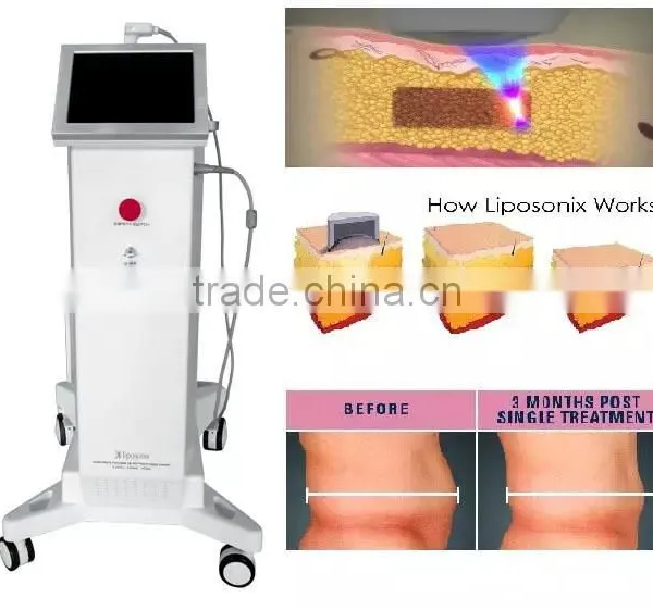 Nasolabial Folds Removal Liposonix High Intensity Focused High Frequency Acne Machine Ultrasound HIFU Body Slimming Machine Face Lifting photo-5