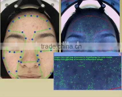 Langdy Factory Direct Sell Facial Skin Analysis Machine Factory Direct Selling Price With CE photo-3