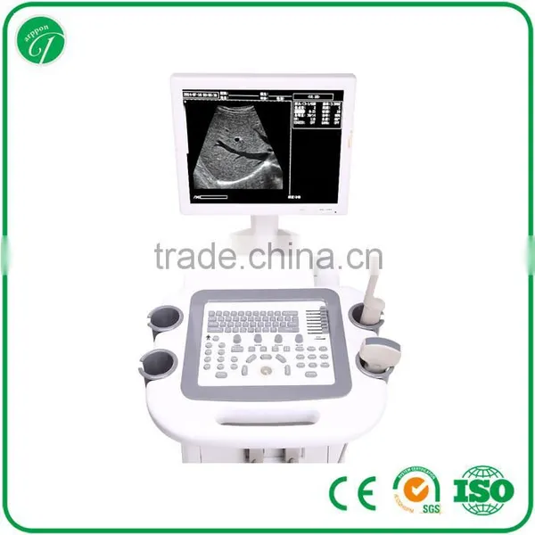 Trolley Ultrasound Scanner / Ultrasound 3018II photo-3