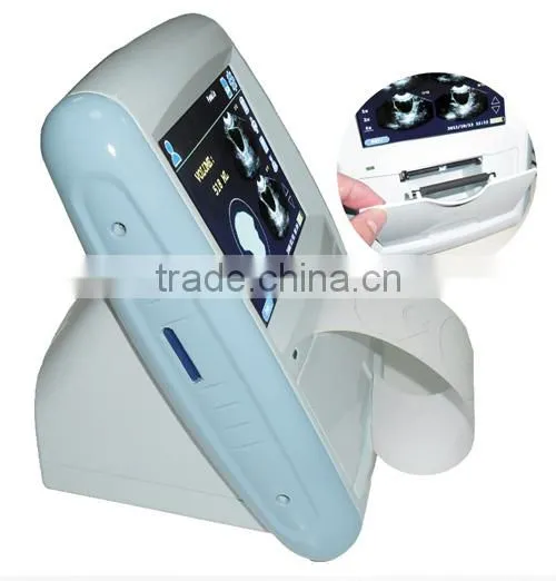 CareScan-1 Bladder Scanner Diagonosis Portable Scanner photo-3